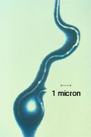 Photomicrograph of Borrelia burgdorferi, the bacterium that cause Lyme disease
