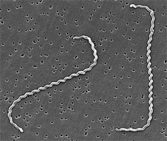 Scanning electron micrograph of Leptospira interrogans strain RGA