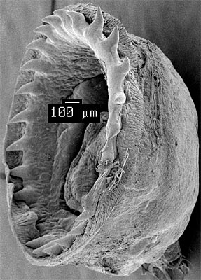 SEM_photograph_of_a_large_dactylus_sucker.